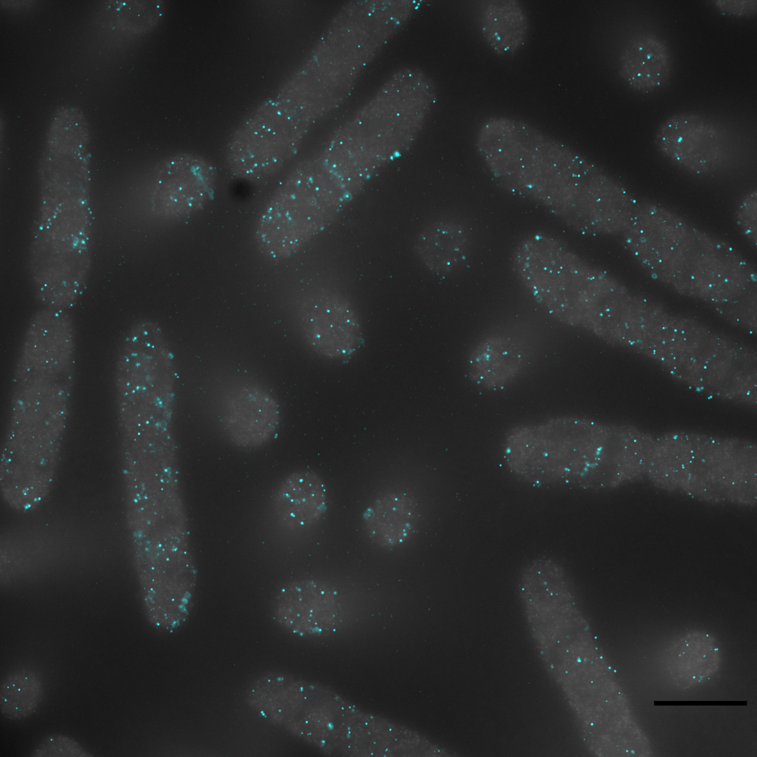 raw MERFISH data (cyan; each dot corresponds to an individual mRNA molecule) overlaid on a cell stain (white; ribosomal RNA stain) in 1000X-expanded E. coli